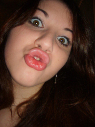 duckface