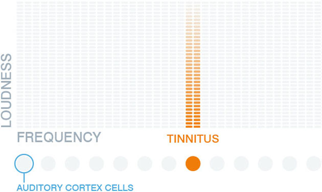 tinnitracks-1