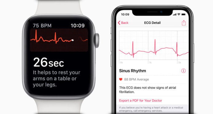 Apple Watch Series 4 心電圖功能將隨 watchOS 5.1.2 推出