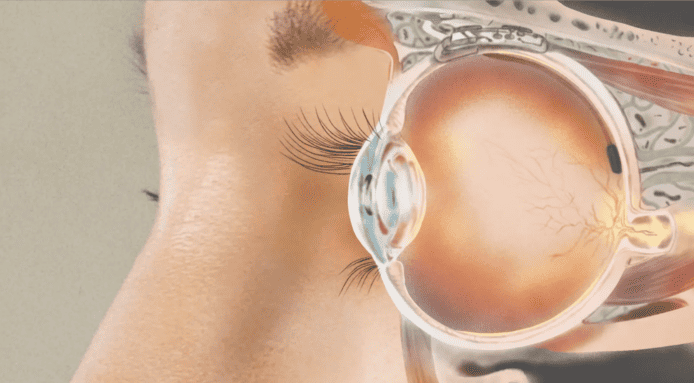 生物公司開發人眼代替品    恢復因視網膜色素變性導致退化的視力